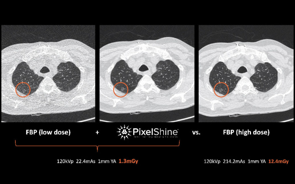 Algomedica PixelShine 