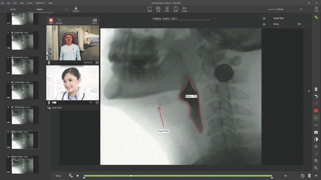 TIMS Medical Releases TIMS Connect