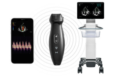 Mindray Introduces 2-in-1 Handheld Ultrasound Device with Multi-device Connectivity