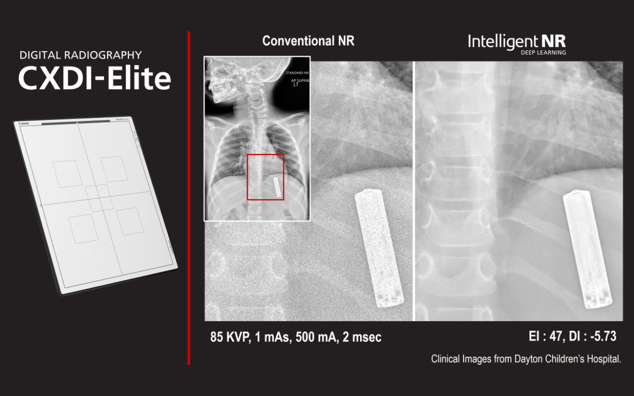 Canon CXDI-Elite Flat Panel Detector Series